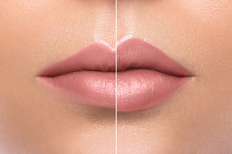 lip enhancement Portsmouth Southampton